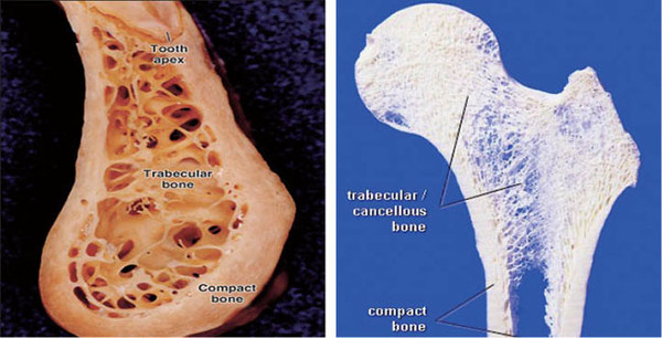 Figure 3-1. compact bone과 trabecular bone으로 구성되어 있으며 피질골과 해면골로 이루어진 부위를 형성했을 때 진정한 골구조(bone structure)를 가지고 있다고 할 수 있다. 골이식한 후 이러한 두 구조(피질골과 해면골)이 구성되지 않은 장소에 임플란트를 식립했을 경우에는 임플란트 주위염의 가능성이 높아진다.